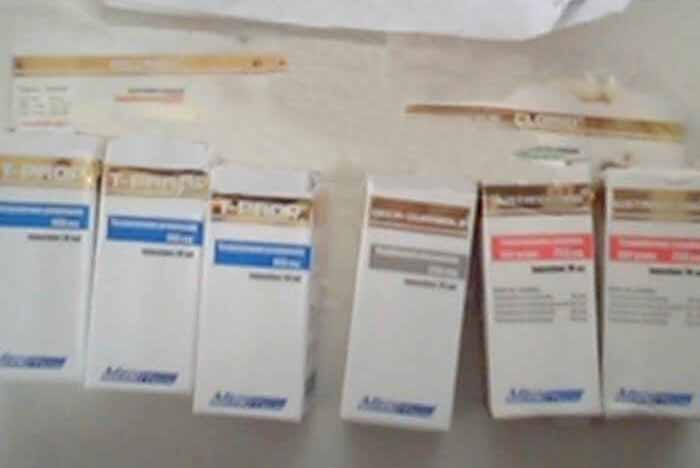 15/02/2018 Versalhes, França